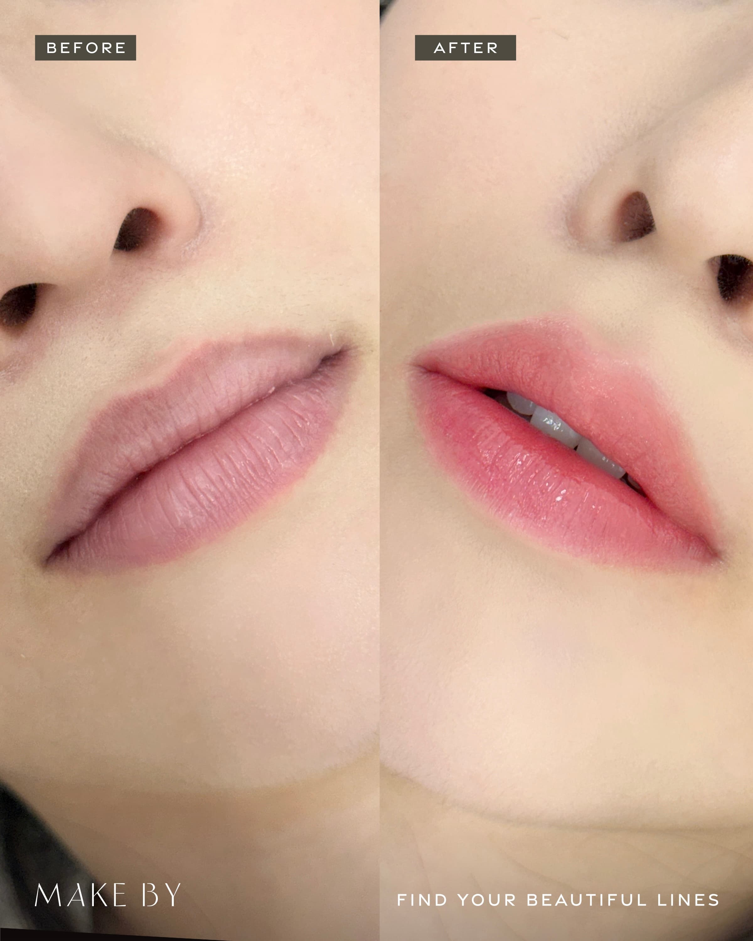 makeby 江南唇部纹绣 半永久案例照片 4